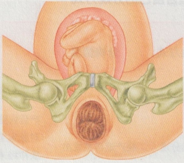 准妈妈分娩前需要准备什么？（2）(图1)